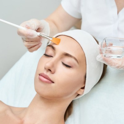 Peeling Químico