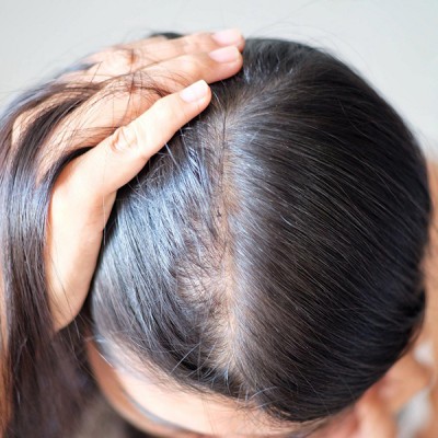 Pelo