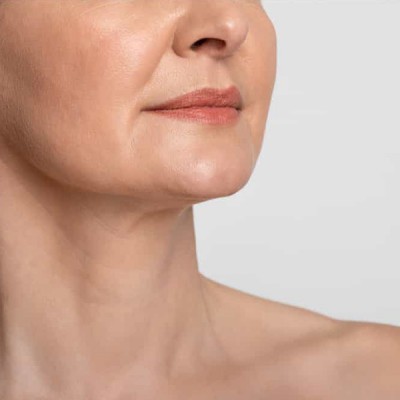 Papada, Cuello y Escote